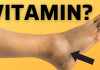Bitni vitamini protiv oticanja nogu,zglobova i članaka