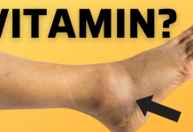 Bitni vitamini protiv oticanja nogu,zglobova i članaka