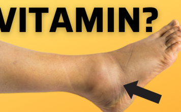 Bitni vitamini protiv oticanja nogu,zglobova i članaka