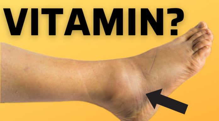 Bitni vitamini protiv oticanja nogu,zglobova i članaka