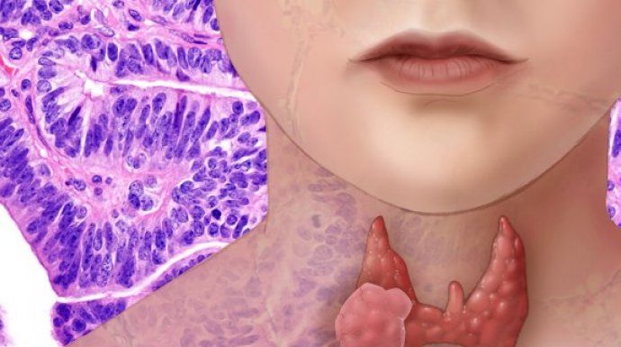 AKO IMATE PROBLEM SA ŠTITNOM ŽLIJEZDOM, OVE 2 NAMIRNICE IZBACITE: Štitna žlijezda ih nikako ne voli