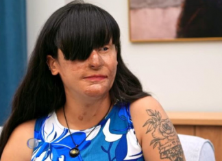 “Nakon raskida polio je kiselinom,oslijepio je i unakazio – Ona nakon 2 godine donijela sok odluku” Borio se za nju 2 godine…”