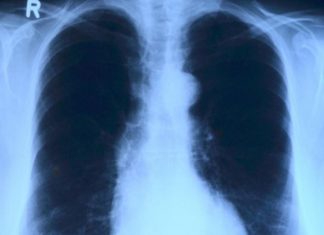 Opaka bolest u porastu, izdali upozorenje građanima: Ovo su simptomi