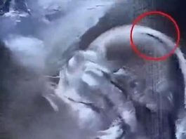 „Beba rođena s gustom kosom oduševila bolnicu – i celu zajednicu“