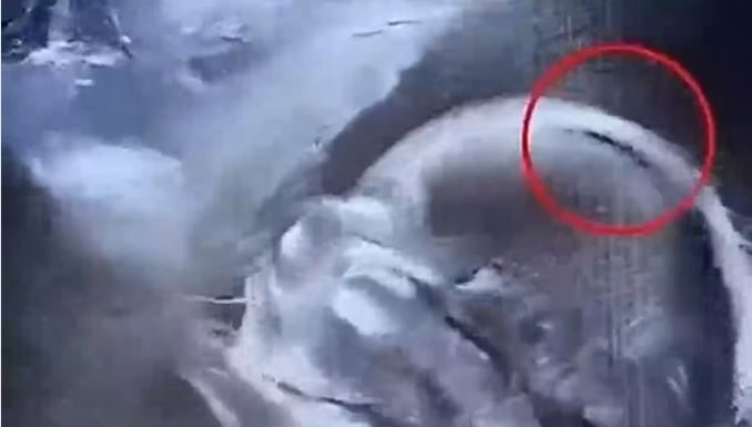 „Beba rođena s gustom kosom oduševila bolnicu – i celu zajednicu“