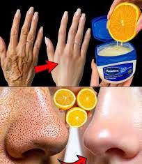 12 ČUDESNIH MOĆI LIMUNA 🍋 Prirodni recepti za savršeno blistavu kožu