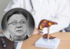 Ovo su najčešće bolesti jetre: Podmukle su i obično se otkrivaju kasno – najteža pokosila Halida Bešlića
