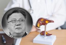 Ovo su najčešće bolesti jetre: Podmukle su i obično se otkrivaju kasno – najteža pokosila Halida Bešlića