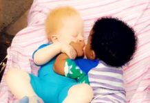 RODILA BLIZANCE, PA ZANEMELA OD ŠOKA: Lekari trčali da ih vide, otac mislio da je greška, sad imaju 5 godina i ČUDNI SU