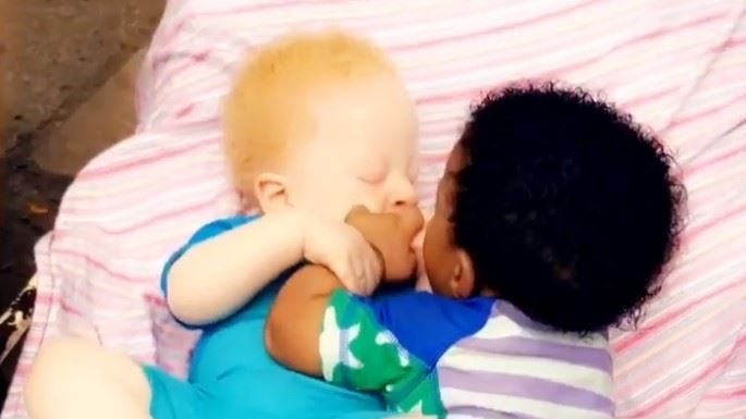 RODILA BLIZANCE, PA ZANEMELA OD ŠOKA: Lekari trčali da ih vide, otac mislio da je greška, sad imaju 5 godina i ČUDNI SU