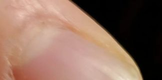 Neočekivano otkriće u salati promenilo je naše veče u restoranu.