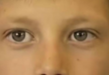 Dečak kojem su se rugali zbog zuba danas se ponosno smeje – priča o hrabrosti, upornosti i dobroti ljudi