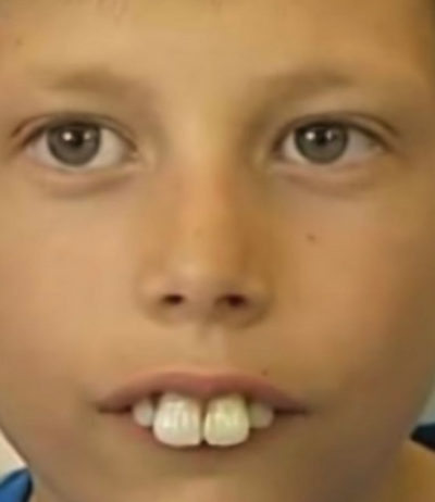 Dečak kojem su se rugali zbog zuba danas se ponosno smeje – priča o hrabrosti, upornosti i dobroti ljudi