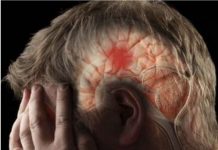 80 posto moždanih udara može se spriječiti: NEUROLOGINJA OTKRILA KAKO