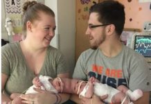 Sijamske bliznakinje rođene su s povezanim glavama, ali su ih lekari uspeli razdvojiti: kako devojčice žive danas.