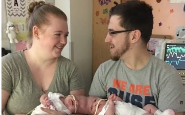 Sijamske bliznakinje rođene su s povezanim glavama, ali su ih lekari uspeli razdvojiti: kako devojčice žive danas.