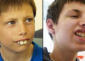 Dečak kojem su se rugali zbog zuba danas se ponosno smeje – priča o hrabrosti, upornosti i dobroti ljudi