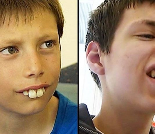 Dečak kojem su se rugali zbog zuba danas se ponosno smeje – priča o hrabrosti, upornosti i dobroti ljudi