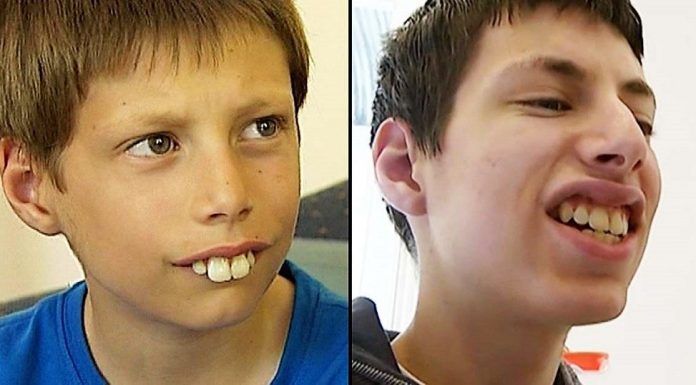 Dečak kojem su se rugali zbog zuba danas se ponosno smeje – priča o hrabrosti, upornosti i dobroti ljudi