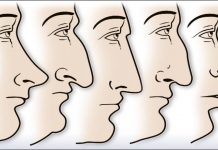 ZVUČI ČUDNO, ALI JE ISTINITO: Evo šta OBLIK NOSA govori O VAMA! Svima je pogodilo