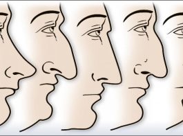 ZVUČI ČUDNO, ALI JE ISTINITO: Evo šta OBLIK NOSA govori O VAMA! Svima je pogodilo