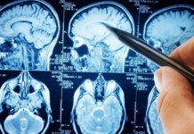 POVRĆE JE TOLIKO ZDRAVO DA O NJEMU PIŠE NJUJORK TAJMS: Amerikanci daju po 30 dolara za jedan list, a ono raste kod nas