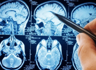 POVRĆE JE TOLIKO ZDRAVO DA O NJEMU PIŠE NJUJORK TAJMS: Amerikanci daju po 30 dolara za jedan list, a ono raste kod nas