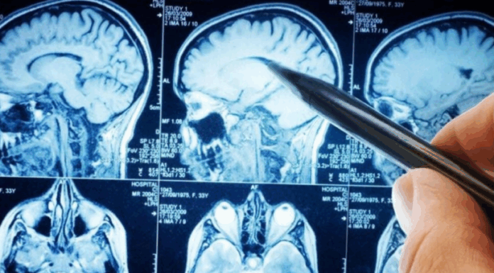 POVRĆE JE TOLIKO ZDRAVO DA O NJEMU PIŠE NJUJORK TAJMS: Amerikanci daju po 30 dolara za jedan list, a ono raste kod nas