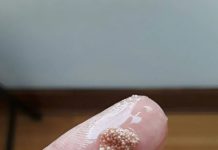 Bele grudvice u jajetu: šta to zaista znači i da li treba da brinete?