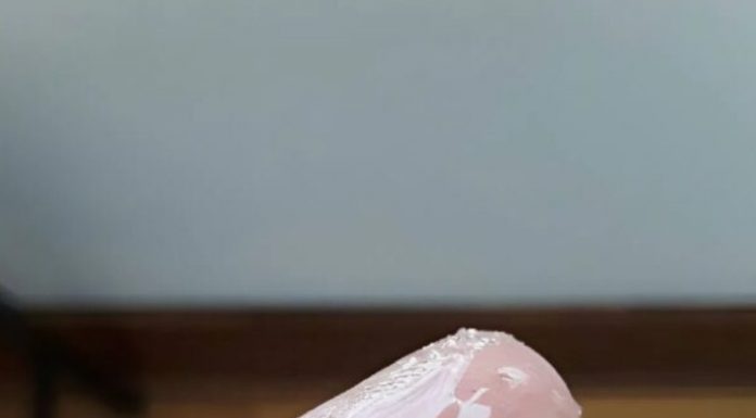 Bele grudvice u jajetu: šta to zaista znači i da li treba da brinete?