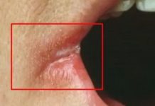 OPASNO PO ŽIVOT: Imate li neki od OVIH simptoma? Nagovještavaju nešto loše!