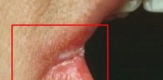 OPASNO PO ŽIVOT: Imate li neki od OVIH simptoma? Nagovještavaju nešto loše!