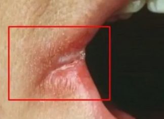 OPASNO PO ŽIVOT: Imate li neki od OVIH simptoma? Nagovještavaju nešto loše!