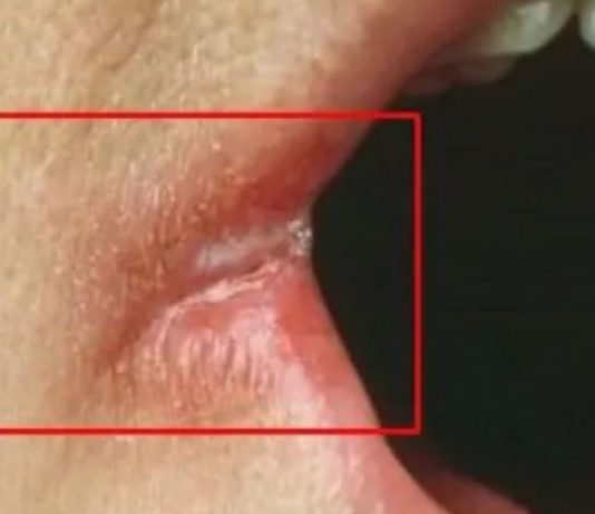 OPASNO PO ŽIVOT: Imate li neki od OVIH simptoma? Nagovještavaju nešto loše!