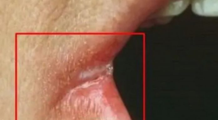 OPASNO PO ŽIVOT: Imate li neki od OVIH simptoma? Nagovještavaju nešto loše!