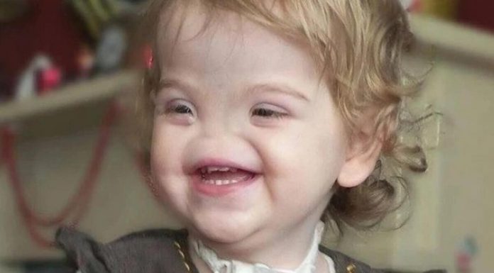 Rođena bez nosa, ali s nevjerovatnom snagom: Inspirativna životna priča djevojčice koja je pobijedila predrasude