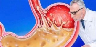 OVO JEDITE ZA VEČERU 3 DANA ZAREDOM: Nećete vjerovati šta će izaći iz vašeg stomaka