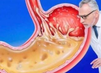 OVO JEDITE ZA VEČERU 3 DANA ZAREDOM: Nećete vjerovati šta će izaći iz vašeg stomaka