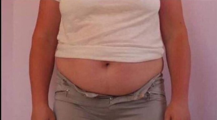 HITNO JE IZBACITE, 1 NAMIRNICA JE GLAVNI UZROK DEBLJINE: Stvara masnoću na stomaku i ugrožava zdravlje