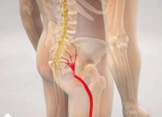 BOL OD IŠIJASA NESTAJE ZA 10 MINUTA: JEDNOSTAVAN METOD RUSKIH DOKTORA!