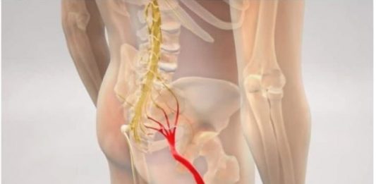 BOL OD IŠIJASA NESTAJE ZA 10 MINUTA: JEDNOSTAVAN METOD RUSKIH DOKTORA!