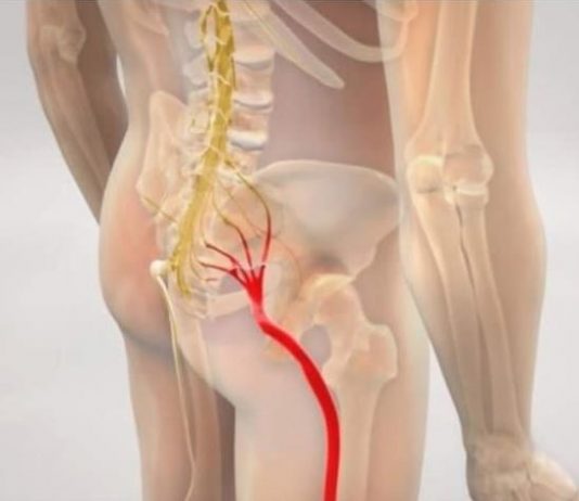 BOL OD IŠIJASA NESTAJE ZA 10 MINUTA: JEDNOSTAVAN METOD RUSKIH DOKTORA!