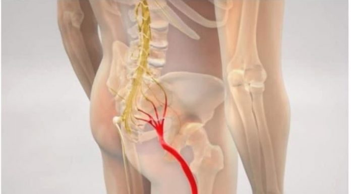 BOL OD IŠIJASA NESTAJE ZA 10 MINUTA: JEDNOSTAVAN METOD RUSKIH DOKTORA!