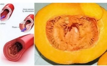 Zlatni recept: recite zbogom povišenom holesterolu, šećeru u krvi, masnoćI I trigliceridima…