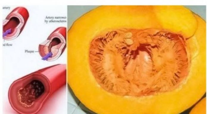 Zlatni recept: recite zbogom povišenom holesterolu, šećeru u krvi, masnoćI I trigliceridima…