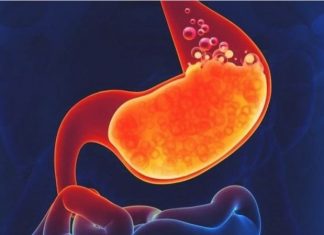 Hrana koja razara želudac: Ove namirnice nikako ne jedite pred spavanje!