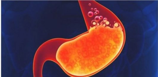 Hrana koja razara želudac: Ove namirnice nikako ne jedite pred spavanje!