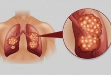 PUŠAČI, PAŽNJA! Za 3 dana izbacite sve otrove iz tijela: Ova metoda skida OTROV SA ZIDOVA PLUĆA, sprečava rak, izbacuje masnoće i višak vode!
