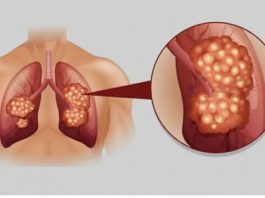 PUŠAČI, PAŽNJA! Za 3 dana izbacite sve otrove iz tijela: Ova metoda skida OTROV SA ZIDOVA PLUĆA, sprečava rak, izbacuje masnoće i višak vode!
