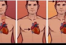 1 ZNAK NA KOŽI UKAZUJE DA JE VAŠE SRCE U LOŠEM STANJU: Ako ovo primijetite javite se doktoru ODMAH!